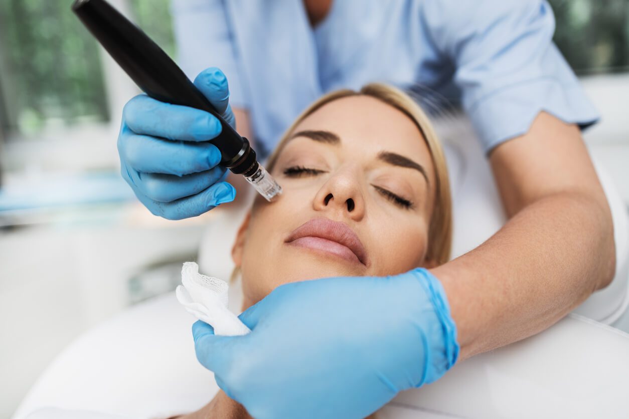 VirtueRF Microneedling in Boca Raton