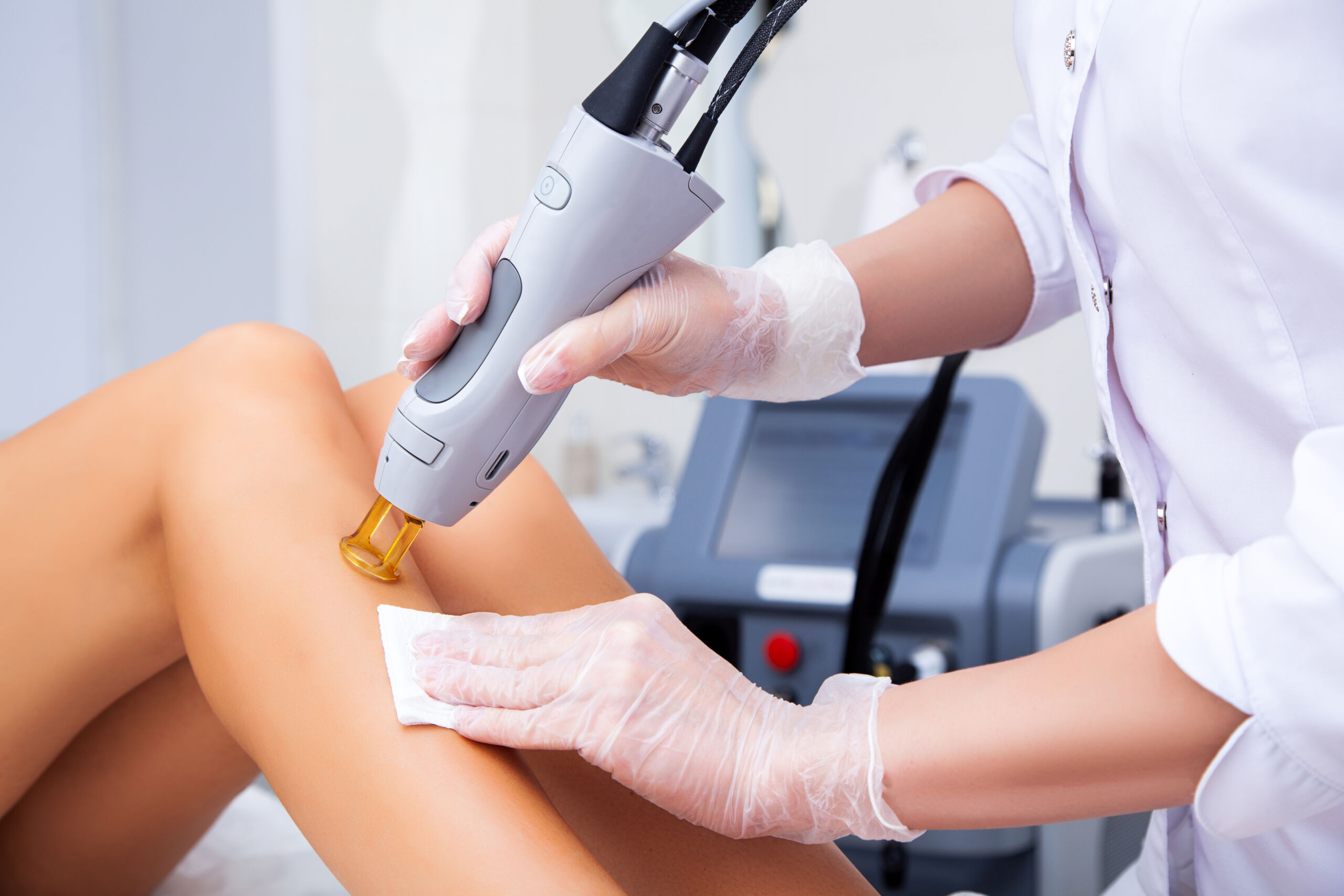 woman receiving laser hair removal - is laser hair removal permanent concept