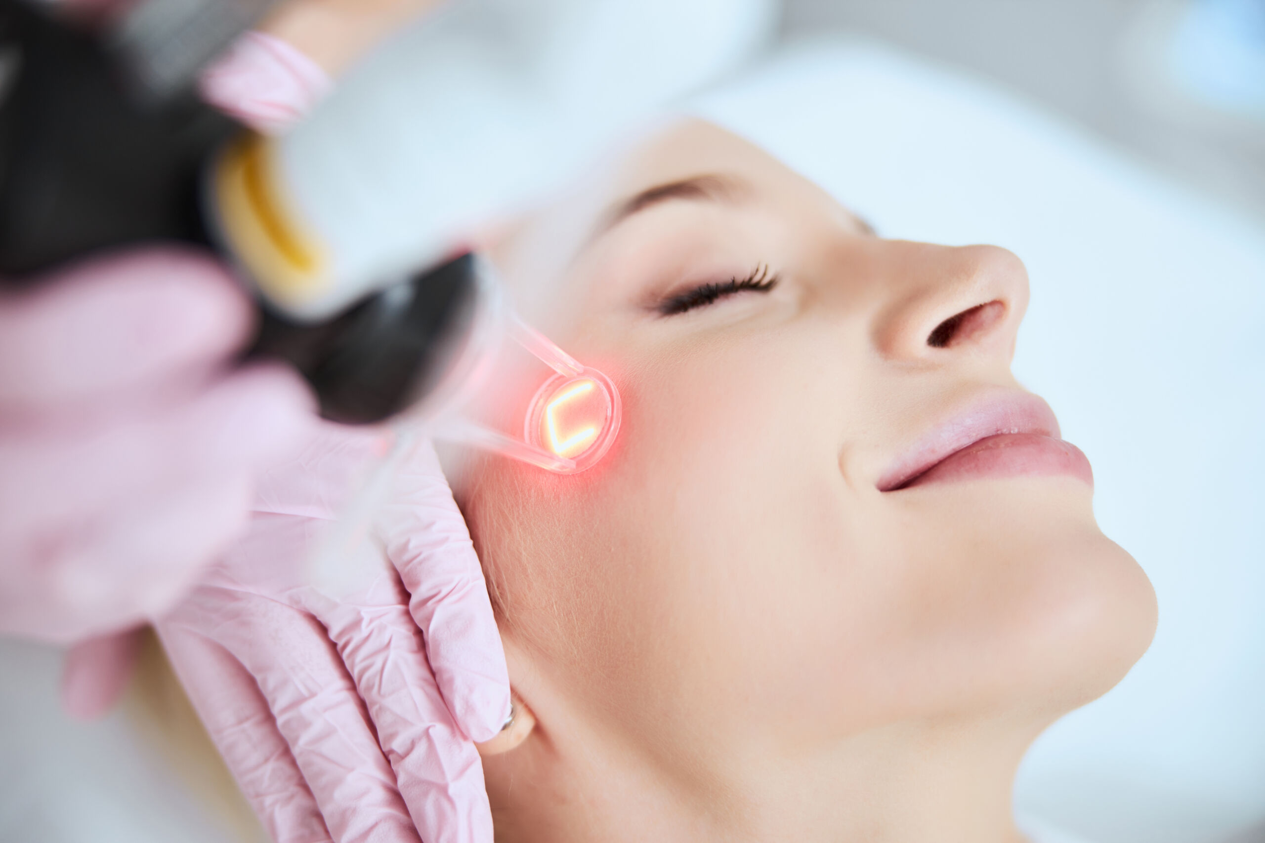 laser skin resurfacing pico laser